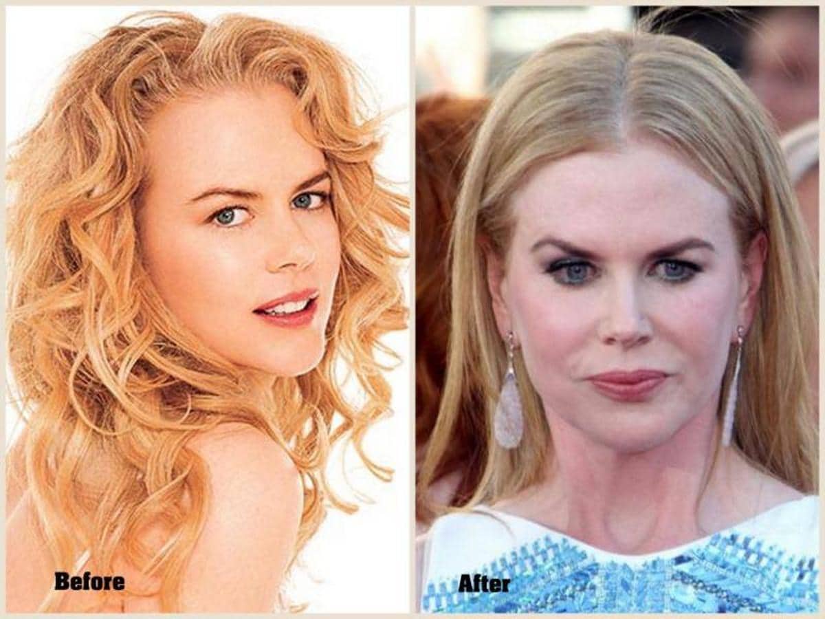 En la imagen pueden apreciarse los cambios que ha experimentado el rostro de la actriz en los últimos años