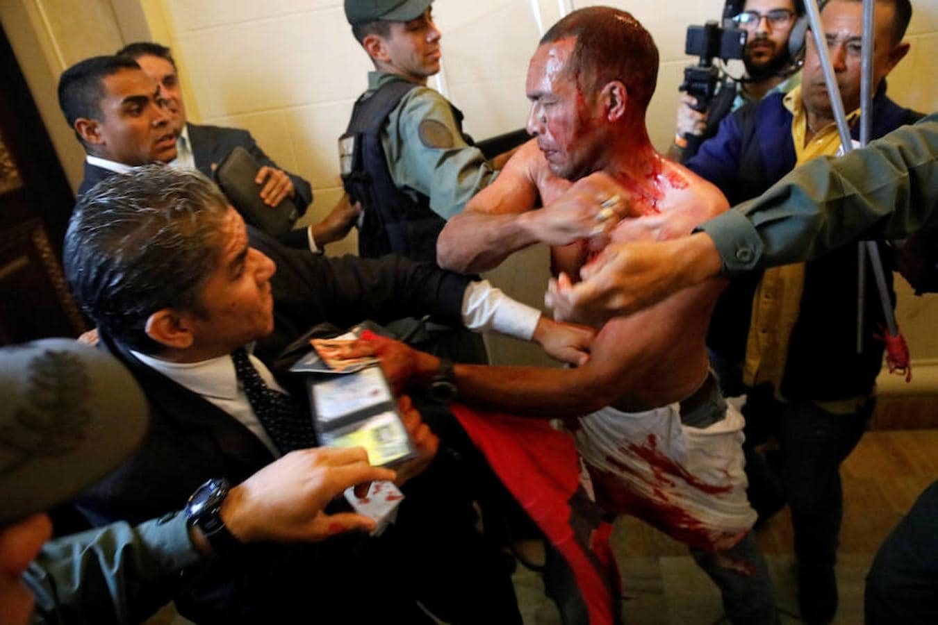 Un parlamentario herido durante el asalto de los partidarios de Chávez al Parlamento de Venezuela
