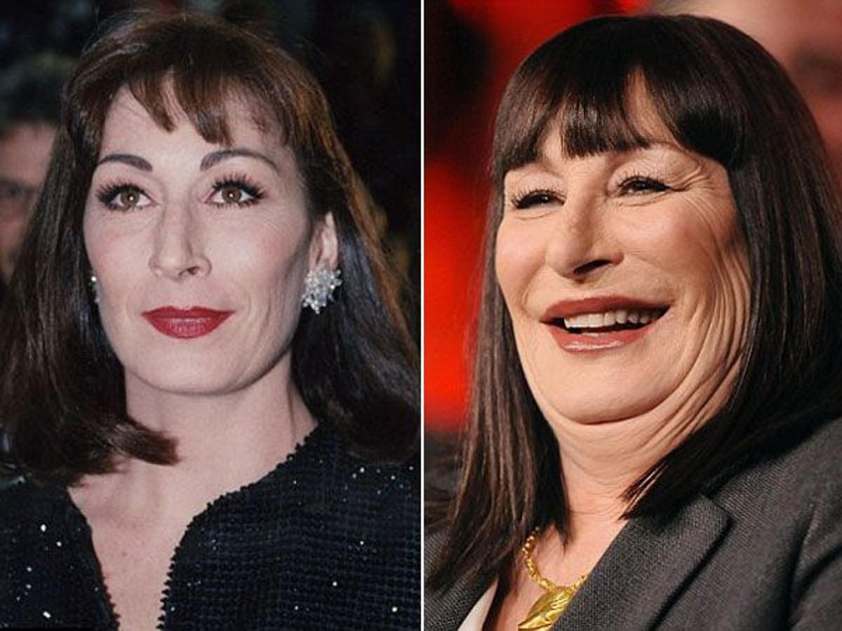 Anjelica Huston. 