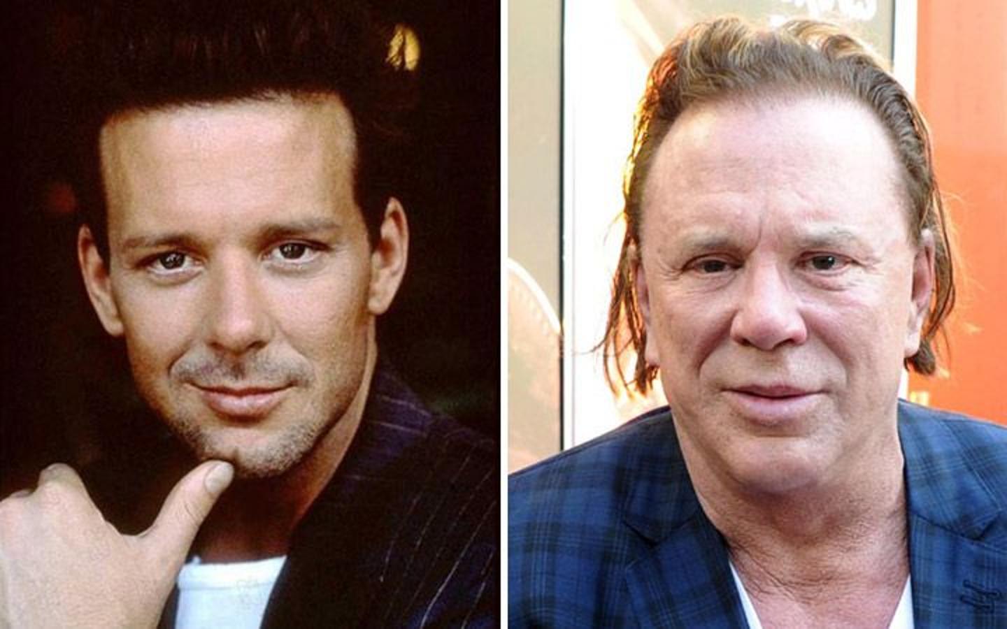 Mickey Rourke. 