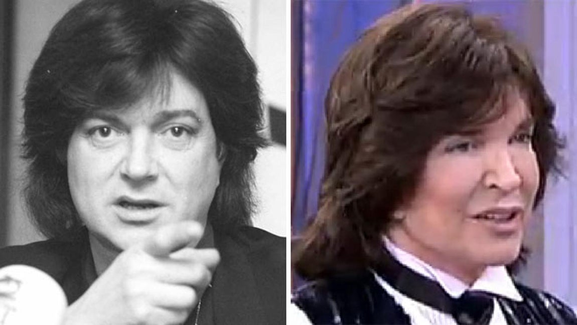 La galería de los horrores estéticos de los famosos