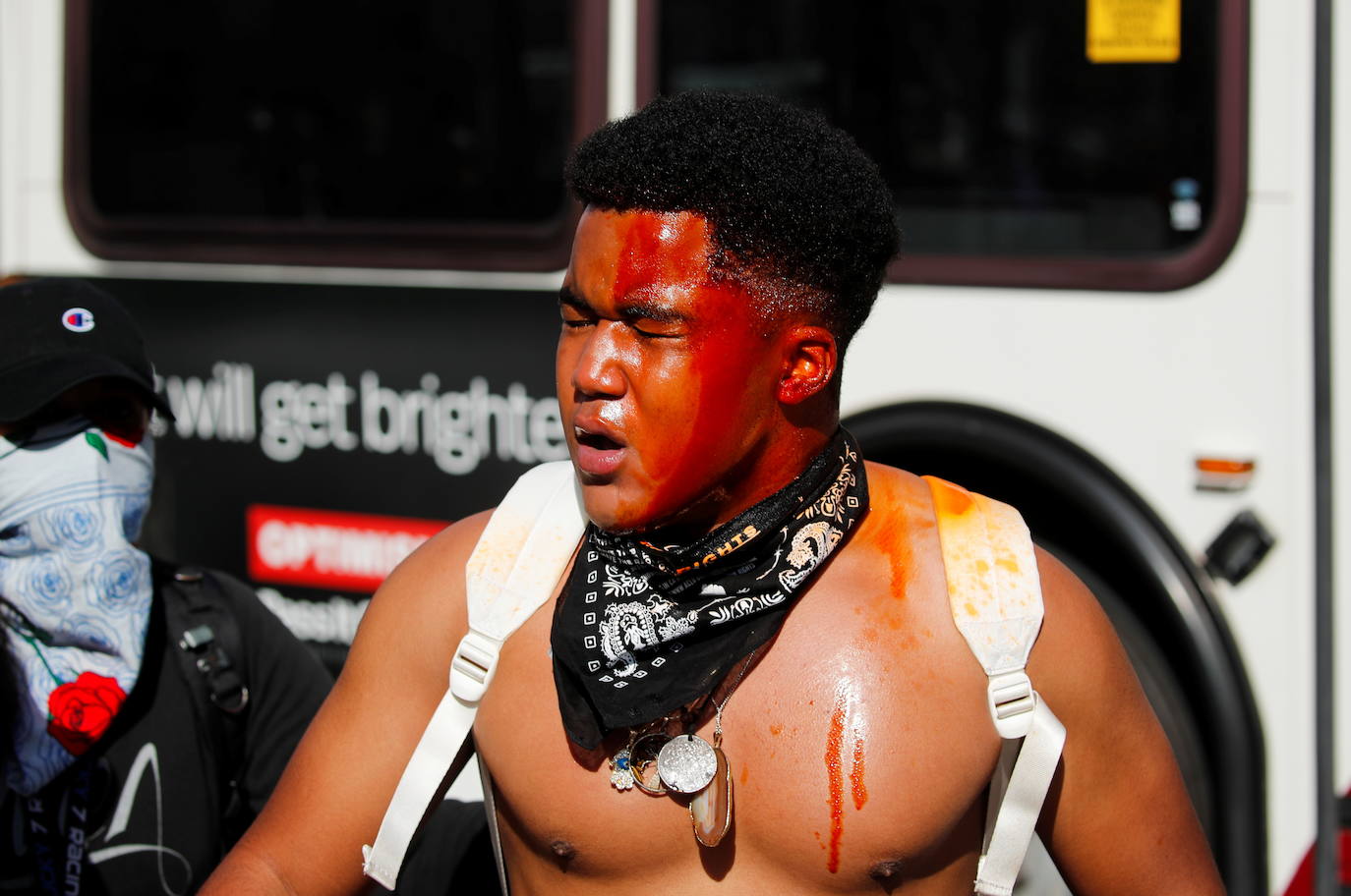 Imagen de un manifestante herido durante el asalto al Capitolio. 