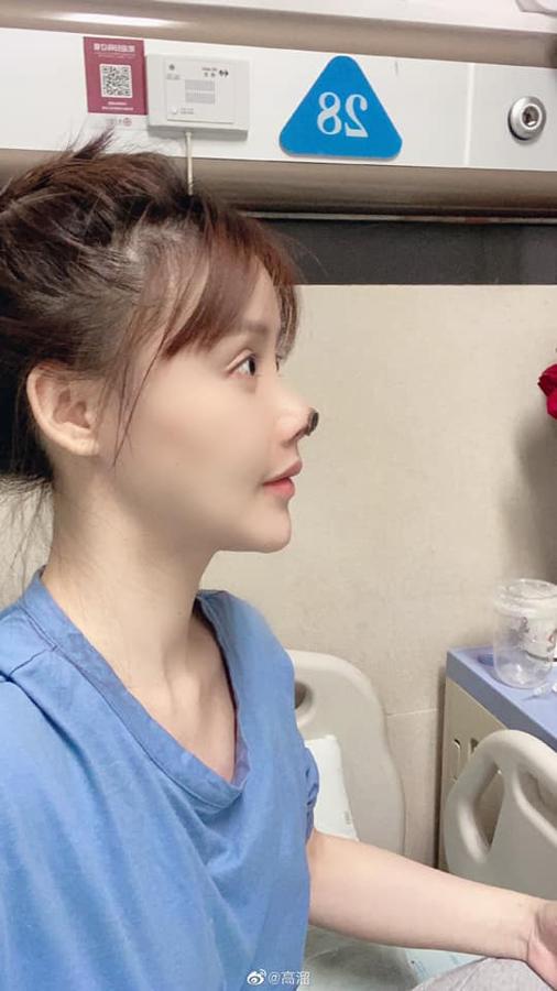 El resultado de la terrible operación estética, en imágenes