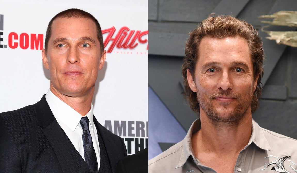 Matthew McConaughey. Otro de los famosos que también ha recurrido al injerto capilar es el actor que luce en la actualidad un cabello abundante. El rapado suele ser uno de los principales inconvenientes al realizar el trasplante, pero se puede disimular con gorras. El nacimiento del nuevo pelo se produce a partir de los tres meses de la operación y es más evidente a partir del sexto mes.