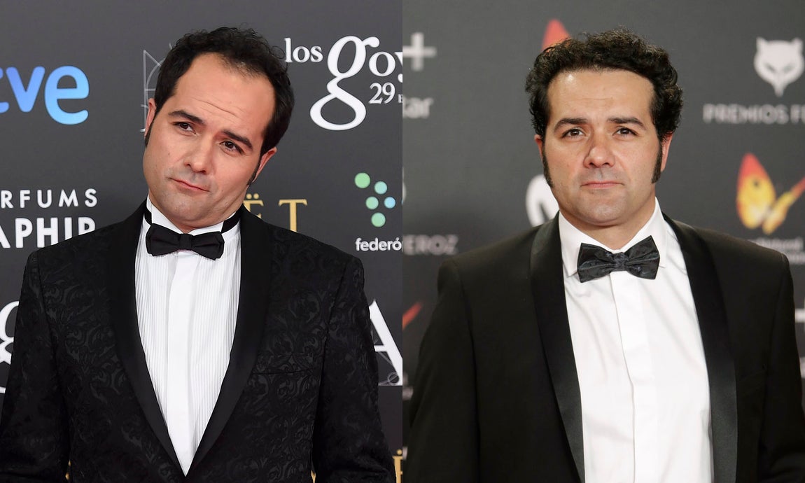 Alfonso Sánchez. Uno de los casos más evidentes de trasplante capilar es el del actor Alfonso Sánchez. La foto de la izquierda es del año 2015 y en ella se aprecian unas entradas evidentes. Tres años después el intérprete lucía un cabello más denso y sin entradas.