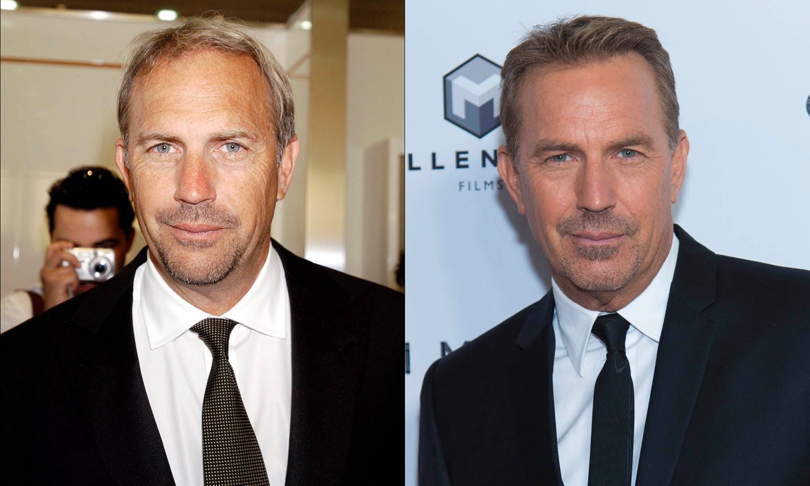 Kevin Costner. A la izquierda, una foto de finales del año 2000, a la derecha una más actual en la que se aprecia que el actor luce una mayor densidad capilar, fruto de un trasplante.