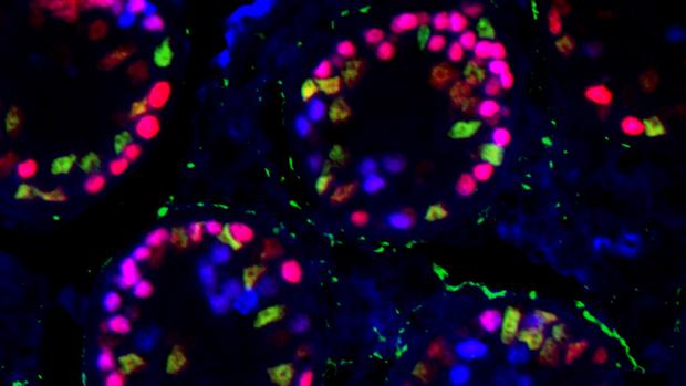 Imagen tomada en el microscopio de fluorescencia en la que aparecen túbulos seminíferos de un testículo mutante en el momento de ocurrir la transdiferenciación sexual. Las células rojas aun son testiculares, y las verdes ya se han transformado en células ováricas