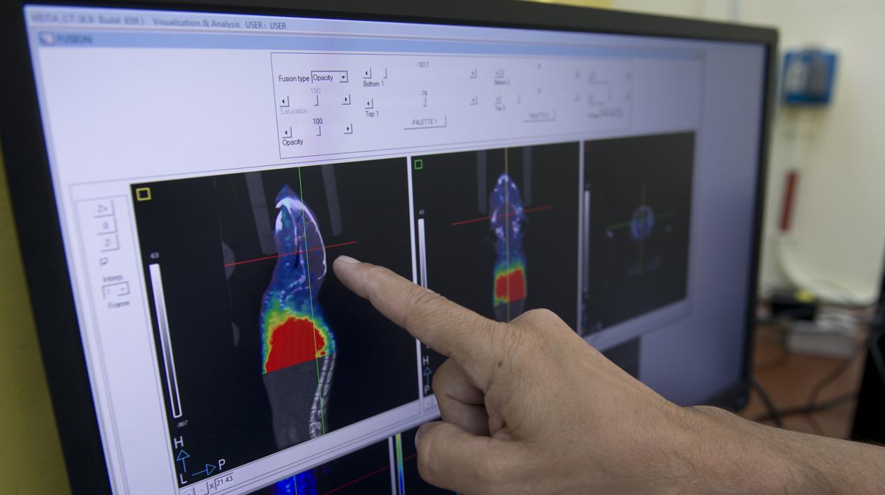 Un médico observa la evolución de un tumor