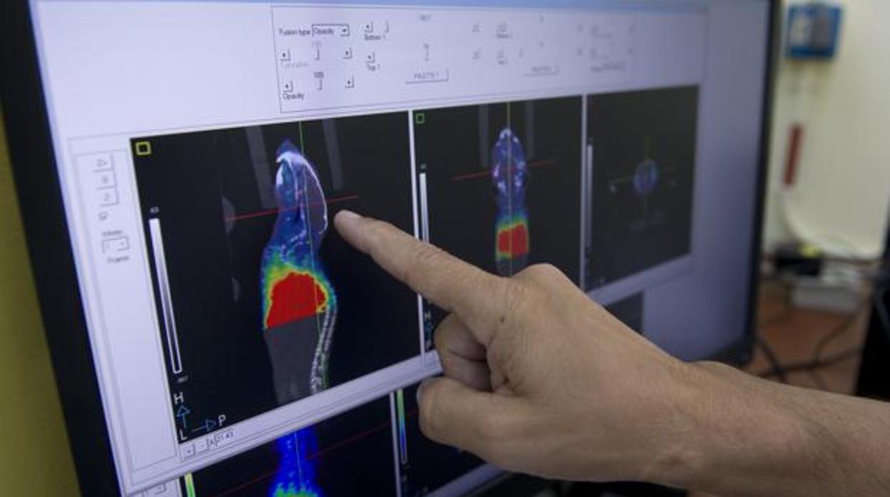 Un médico examina la evolución de un tumor