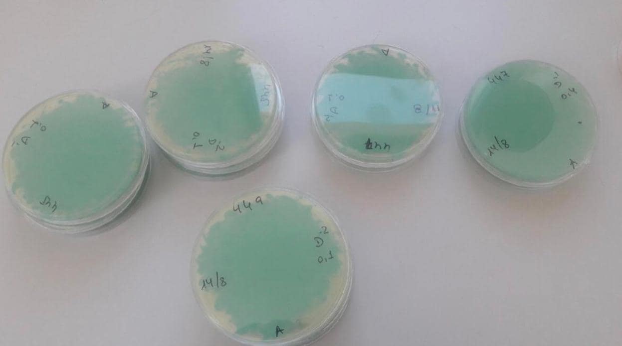 Imagen de la fotografía con los primeros cultivos de las bacterias de la listeria que se analizaron