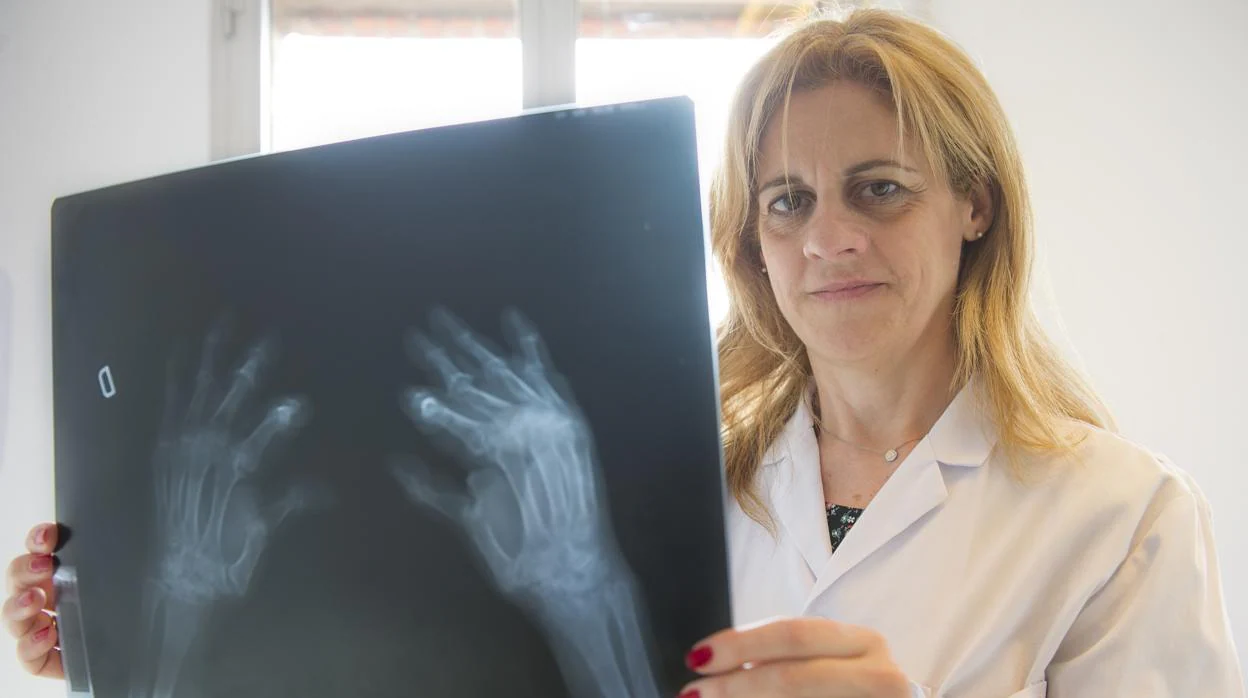 Una profesional mira los resultados de una radiografía de manos