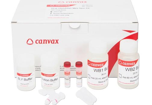 Kit para detectar el coronavirus