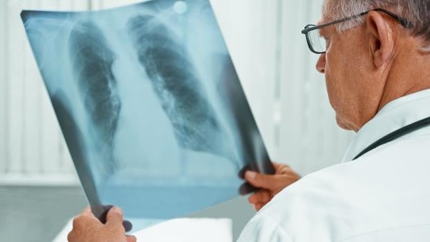 Tuberculosis, la epidemia que no acaba de extinguirse en Andalucía