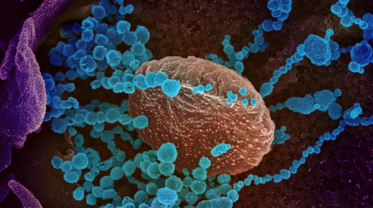 Imagen de un microscopio que muestra el virus del SARS-CoV-2