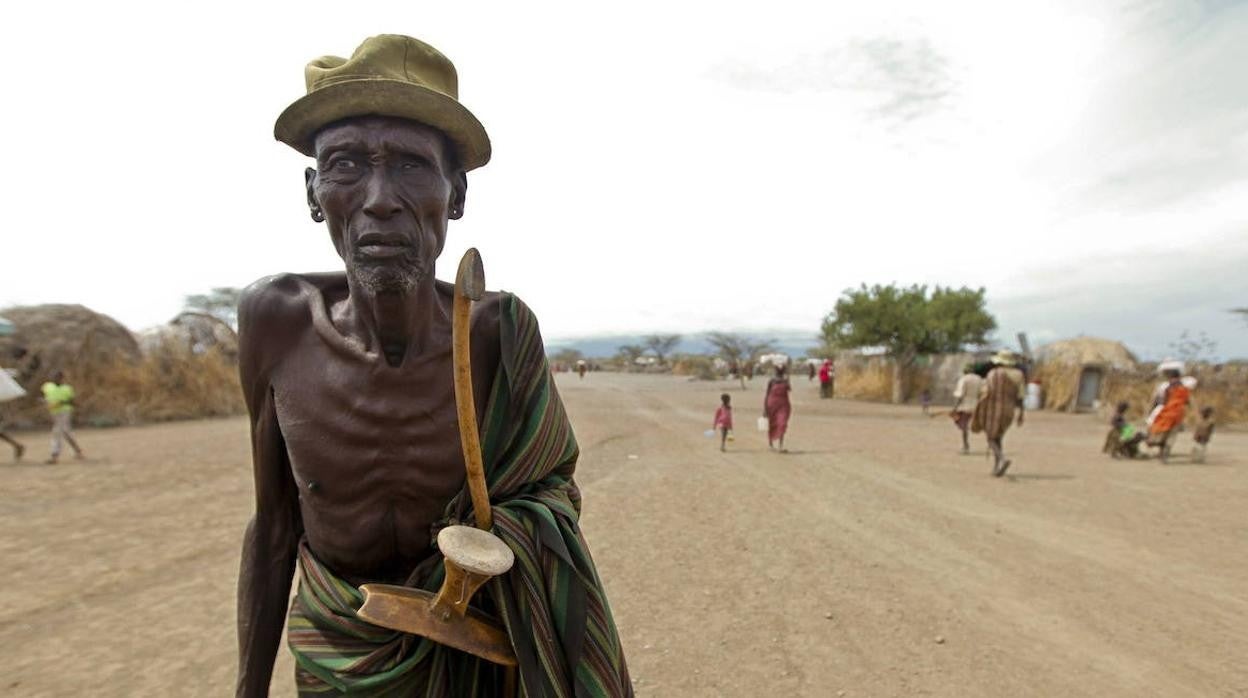 Un hombre víctima de la hambruna en el 'cuerno de África'.