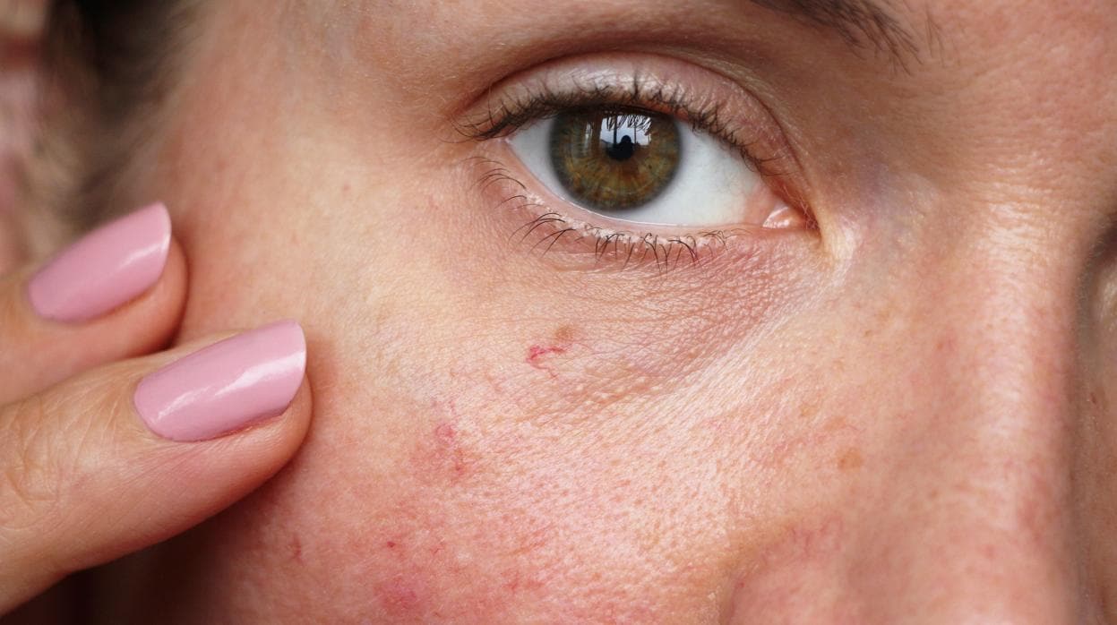 Durante el verano, nuestra piel sufre más de lo normal y como resultado hay cambios en su pigmentación