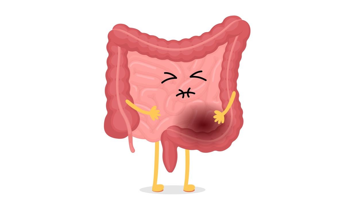 Cómo mejorar el estado de tu microbiota.