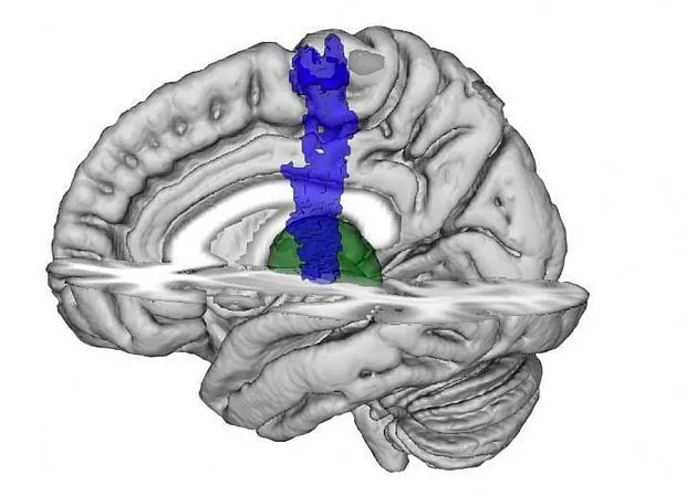 Imagen de cerebro que muestra la ubicación del tálamo (verde) y corteza motora primaria (azul)