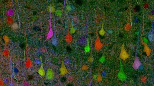 Enel cerebro no hay dos neuronas iguales