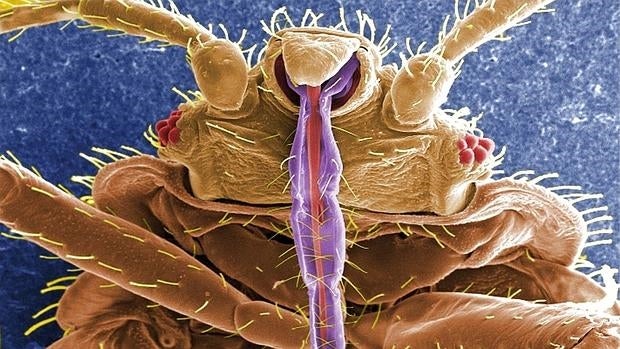 Una chinche, fotografiada a través un microscopio electrónico