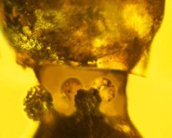 Las glándulas del cuello