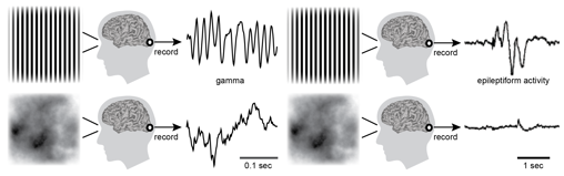 Los mismos patrones visuales que provocan un tipo específico de ondas cerebrales (oscilación gamma) en la corteza visual saludable también pueden desencadenar convulsiones en pacientes con epilepsia fotosensible. Superior izquierda: los patrones de rejilla de alto contraste inducen oscilaciones gamma en la corteza visual. Superior derecha: los mismos patrones que provocan oscilaciones gamma son también los más propensos a causar convulsiones en pacientes con epilepsia fotosensible. Abajo izquierda: los patrones de nubes no provocan grandes oscilaciones gamma y tampoco es poco probable que desencadenen actividad epiléptica.