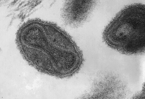 Virus de la viruela ampliado unas 370.000 veces. Este patógeno fue derrotado por las vacunas