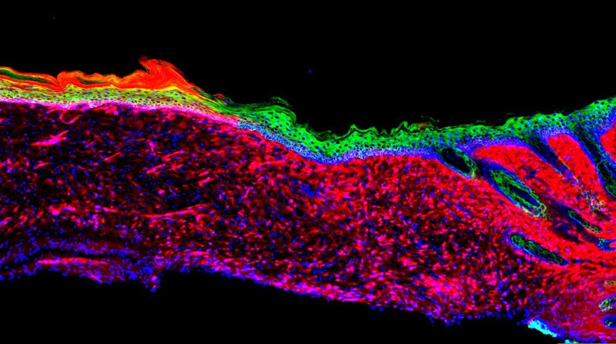La imagen representa la primera prueba para la regeneración exitosa de un órgano funcional (la piel) dentro de un mamífero