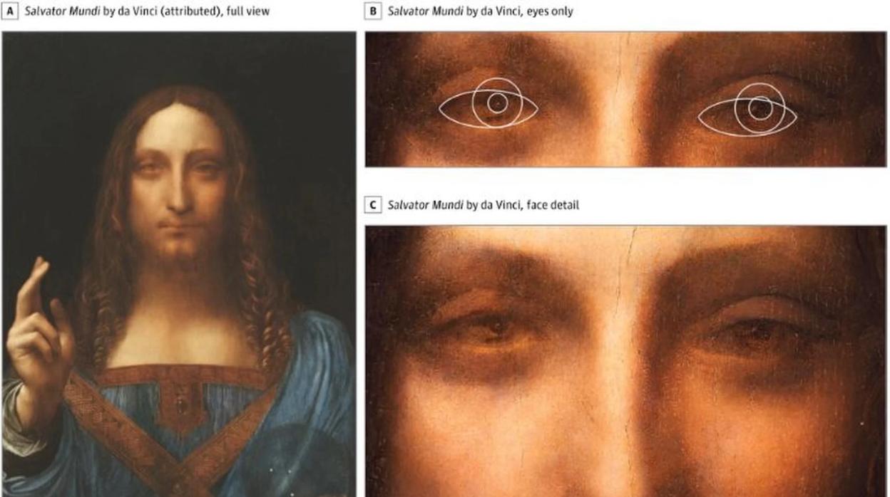 «Salvator Mundi», una pintura recientemente atribuida a da Vinci, mostraría algunos rasgos de su propio autor, como su estrabismo, según una investigación