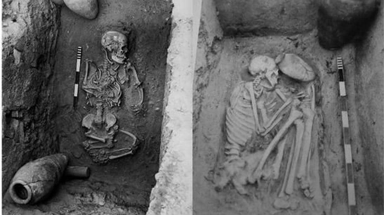 A la izquierda, un esqueleto de una persona con acondroplasia; a la derecha, una persona sin esta patología