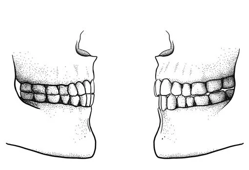 Diferencia entre la mordida del Paleolítico (izquierda), con los dientes superiores e inferiores alineados, y la moderna (derecha), con los dientes superiores adelantados