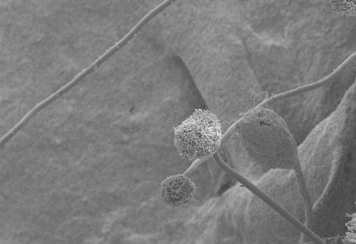 Fotografía de microscopía electrónica de varias estructuras de un hongo del género «Aspergillus»