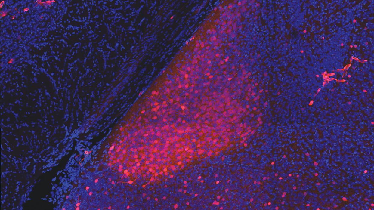 Neuronas activadas por la darcina (en naranja) en la amígdala medial del cerebro de una hembra de ratón