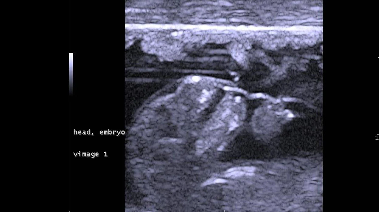Imagen de ultrasonido de un feto de ualabí del pantano en el día 29 de gestación. La imagen muestra la cabeza y el antebrazo del feto aproximadamente 1 día antes del nacimiento