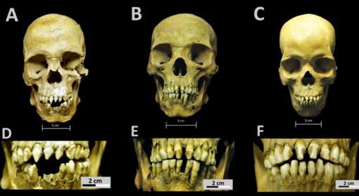 Cráneos y patrones de modificación dental de los tres africanos del Hospital Real San José de los Naturales