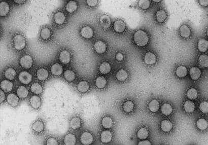 Fotografía al microscropio de varios coronavirus