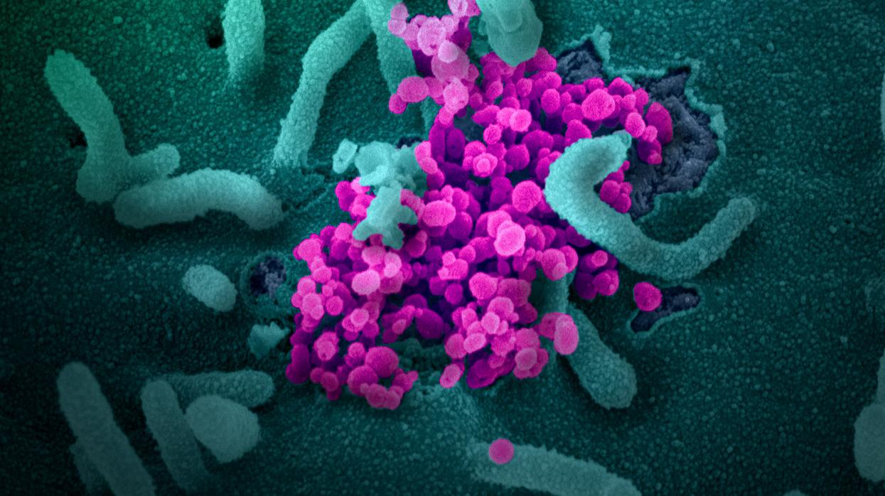 Fotografía coloreada de varios virus adheridos a una célula y vistos al microscopio electrónico