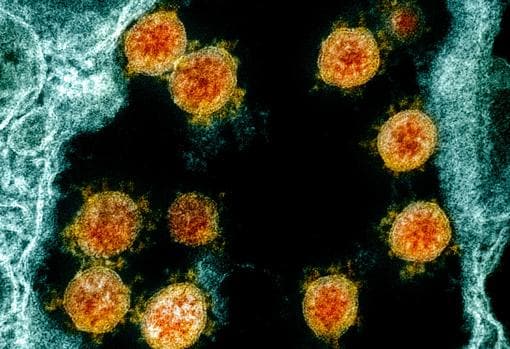 Varias partículas del virus SARS-CoV-2 (en naranja). Algunas vacunas evitan los síntomas que causa pero no su transmisión