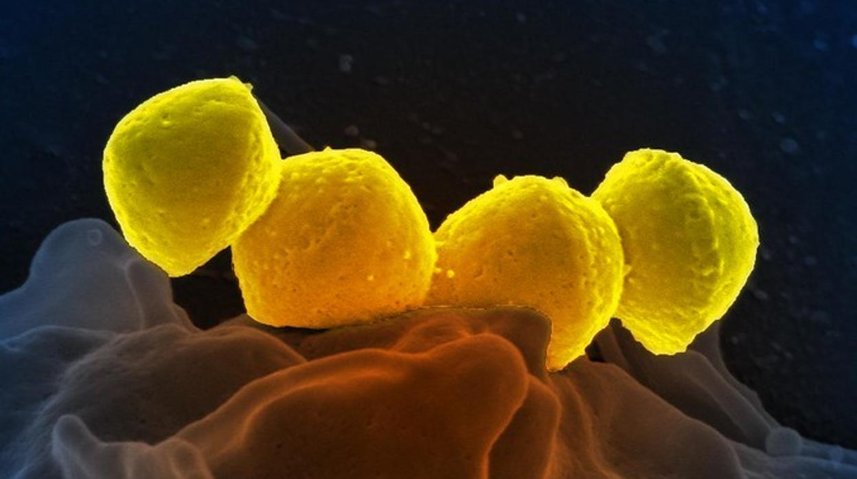 Fotografía de la bacteria «Streptococcus pyogenes», causante de la escarlatina