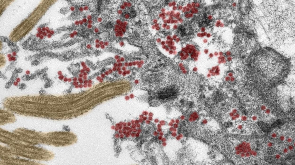 La imagen de microscopio electrónico, coloreada artificialmente, muestra una sección de una cñelula ciliada en la mucosa olfativa. Un gran número de partículas de SARS-CoV-2 intactas (en rojo) se encuentran dentro de la célula