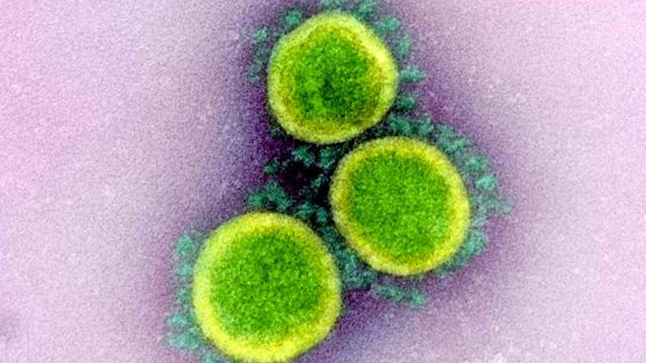 «TMEM41B», la proteína que podría ser clave para bloquear el coronavirus