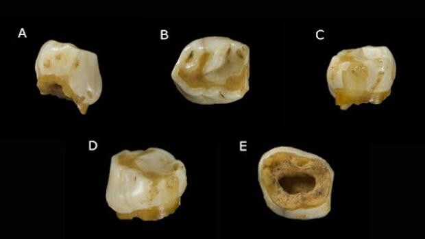La niña «Vera», la última neandertal de Burgos