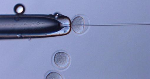 Inyección de espermatozoides espaciales en los ovocitos