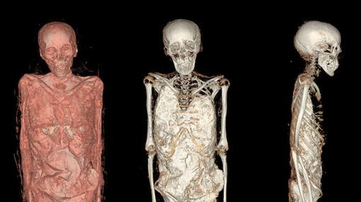 Así se ven las momias del Museo Arqueológico tras el escáner 3D