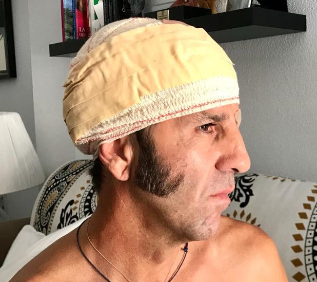 Juan José Padilla, tras su percance: «No veo motivos para no torear en San Fermín»
