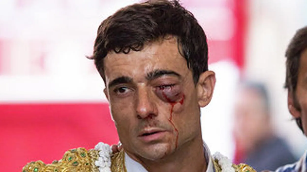 La sangre cae por el rostro de Paco Ureña, con el ojo amoratado y cerrado