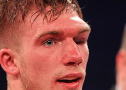 El boxeador Nick Blackwell sale de su segundo coma en menos de un año