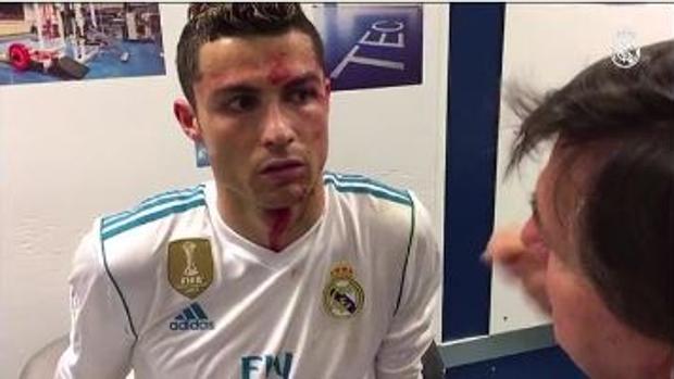 Así fue la cura de Cristiano Ronaldo