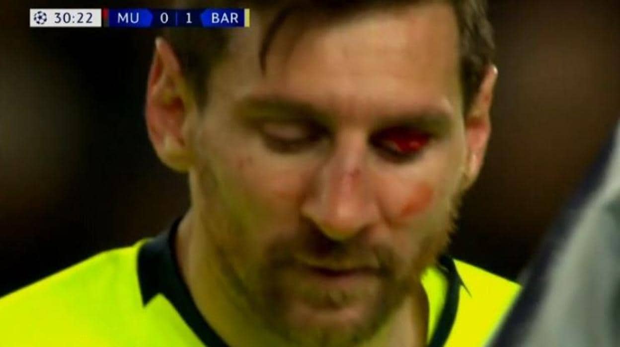 Así quedó el rostro de Messi tras el choque con Smalling