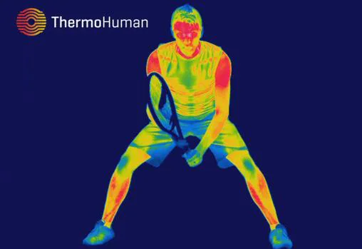 Imagen de termografía de ThermoHuman. Los colores revelan distintas temperaturas y sirven para determinar indicios de un exceso de carga o una inflamación